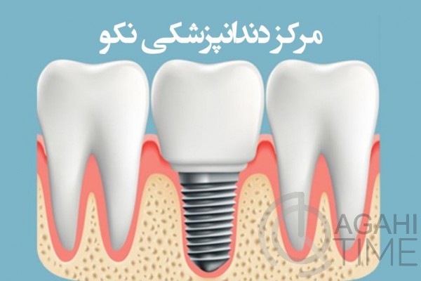 متخصص ایمپلنت محدوده غرب تهران | مرکز دندانپزشکی نکو