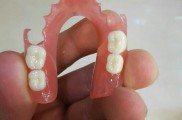 لابراتوار دندانسازی ساخت دندان مصنوعی باضمانت