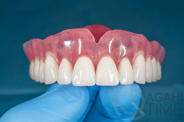 دندان مصنوعی ژله ای نرم و راحت لابراتوار دندانسازی