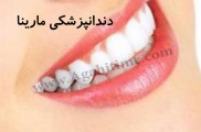 دندانپزشکی مارینا |  مرکز تخصصی دندانپزشکی در غرب تهران
