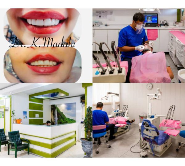 ایمپلنت دندان در صادقیه | کلینیک خیریه الزهرا